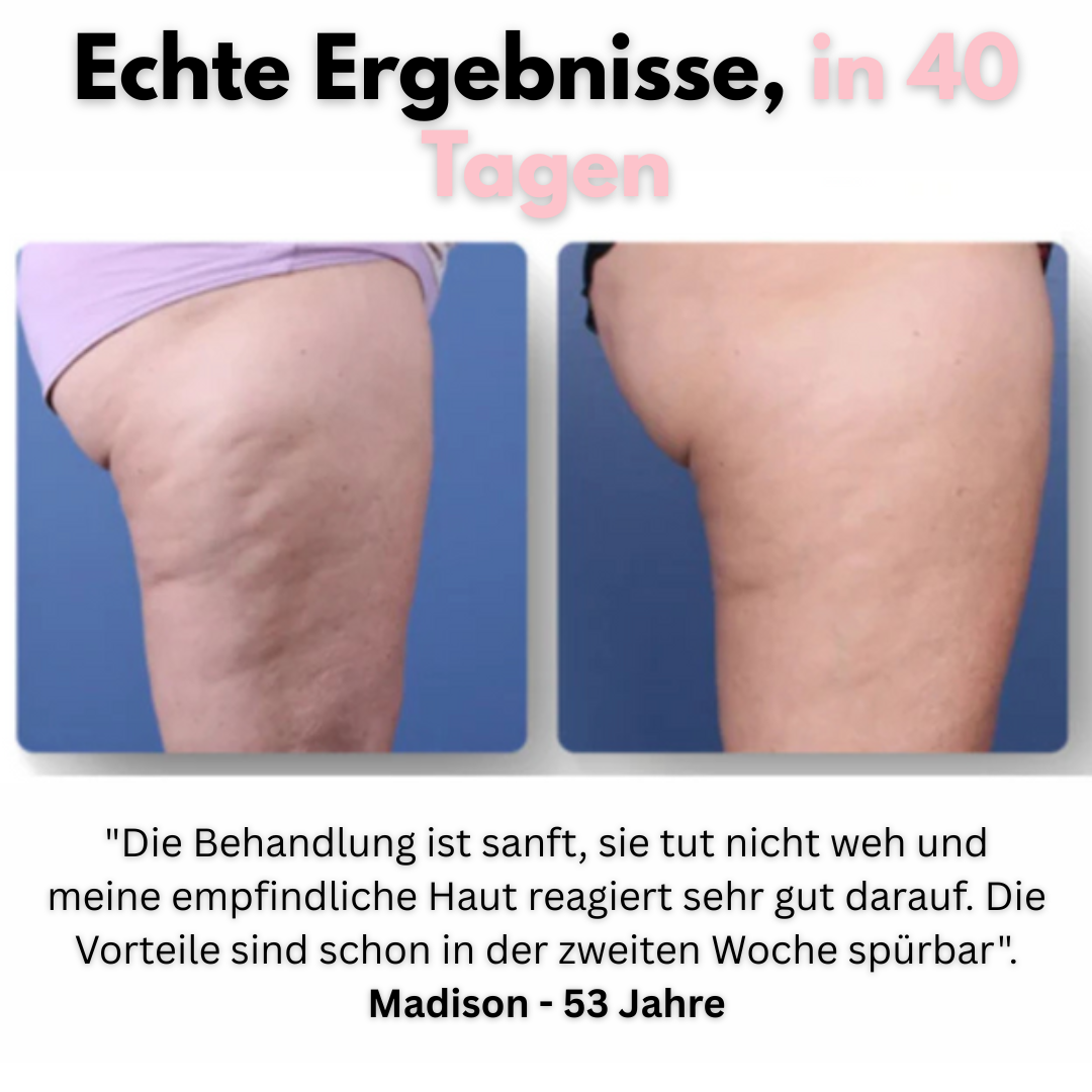Veluxa™ - Massagegerät