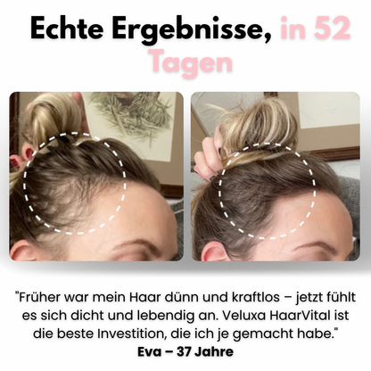 Veluxa™ HairÉclat