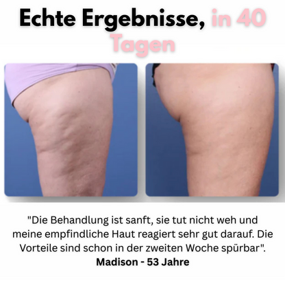 Veluxa™ - Masseur