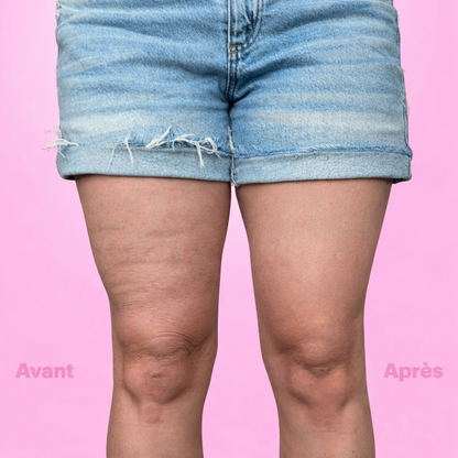 Bandes Sculptantes Veluxa™