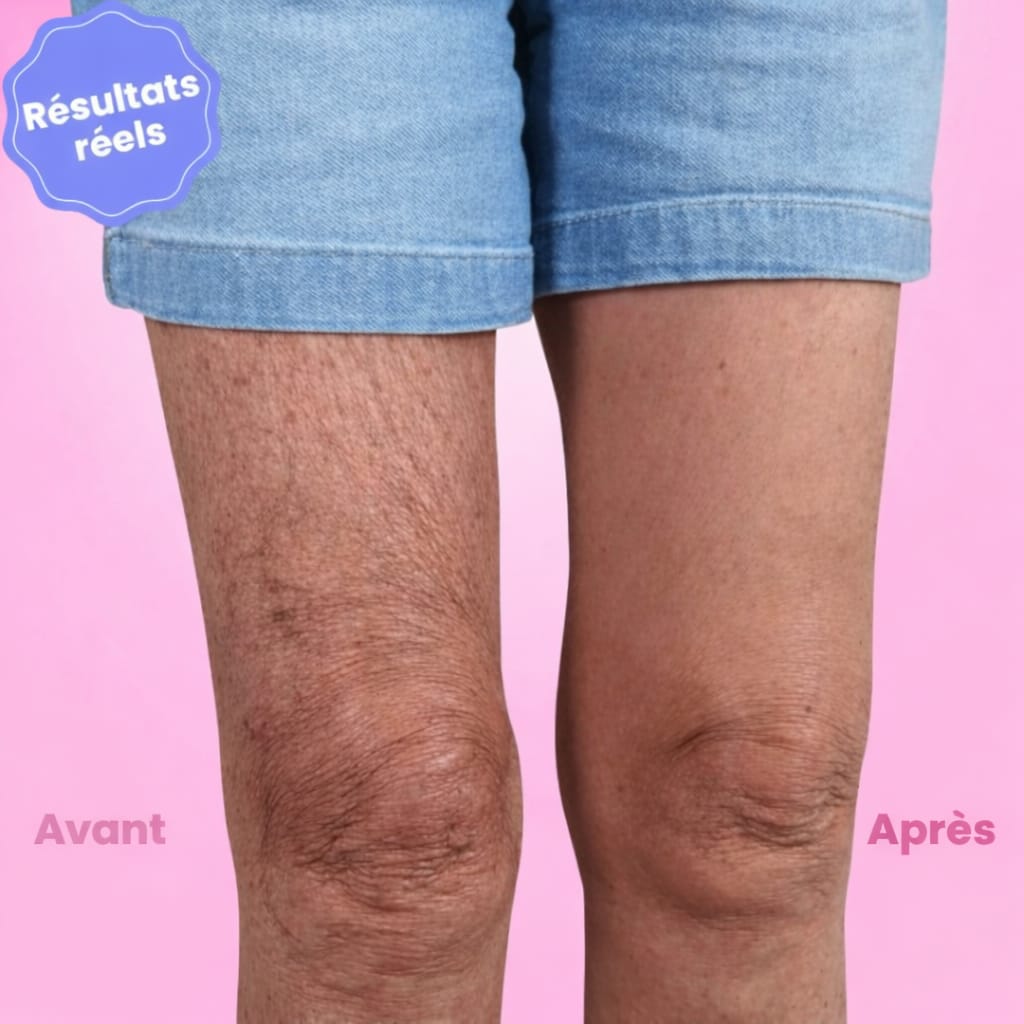 Bandes Sculptantes Veluxa™