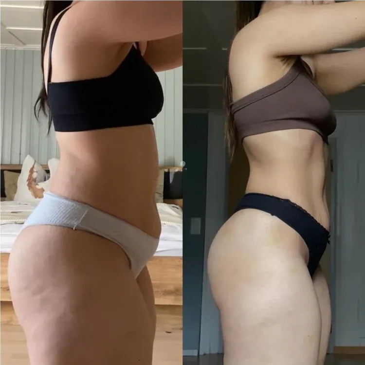 Veluxa® - Patchs Berbérine Naturels 24h