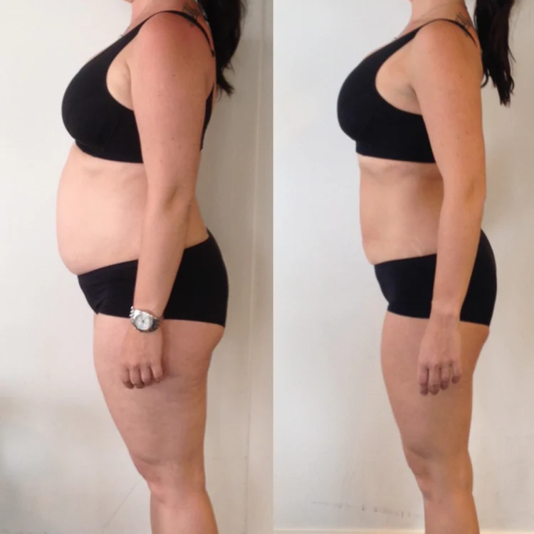 Veluxa® - Patchs Berbérine Naturels 24h